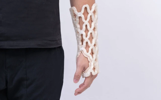 Castomize Develops 4D Printed Orthopaedic Casts With Remouldable Smart Material
